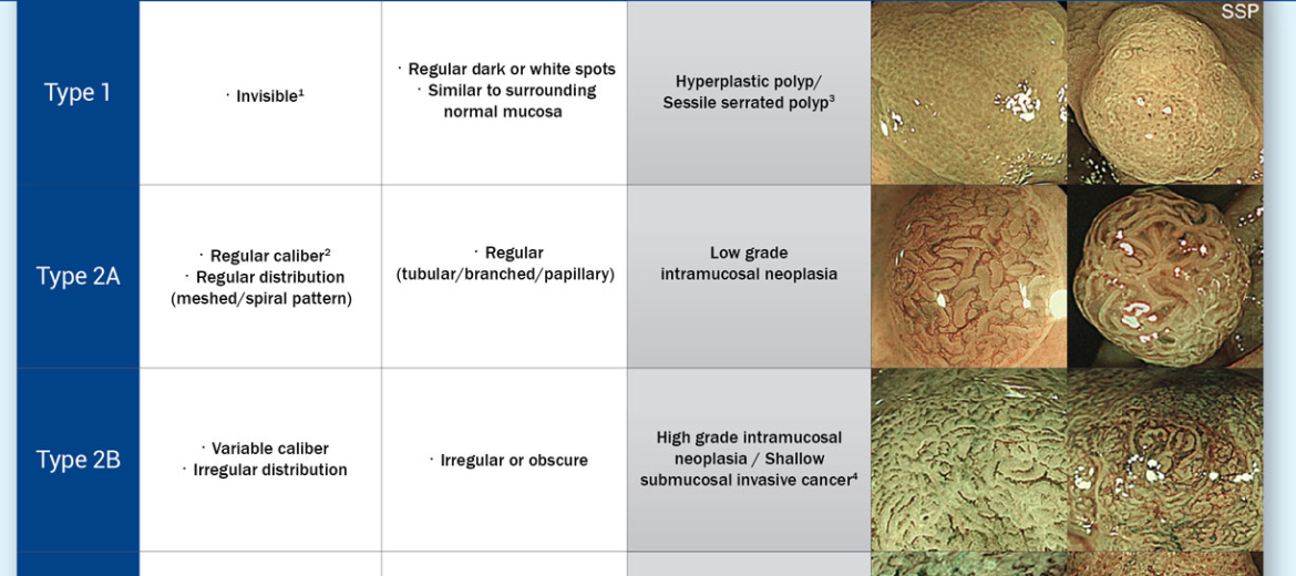 Đánh giá polyp đại trực tràng bằng phân loại JNET
Đánh giá polyp đại trực tràng bằng phân loại JNET